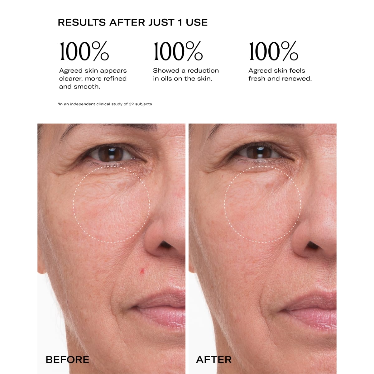 Plumtox Results Plumtox Results